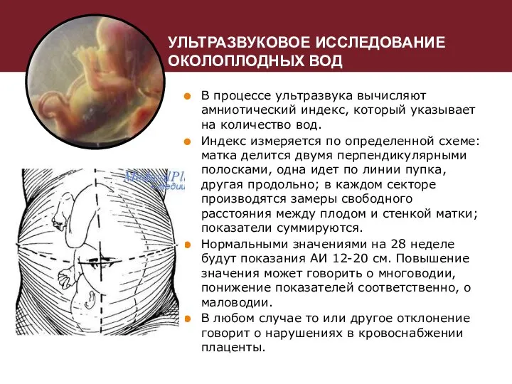 УЛЬТРАЗВУКОВОЕ ИССЛЕДОВАНИЕ ОКОЛОПЛОДНЫХ ВОД В процессе ультразвука вычисляют амниотический индекс, который