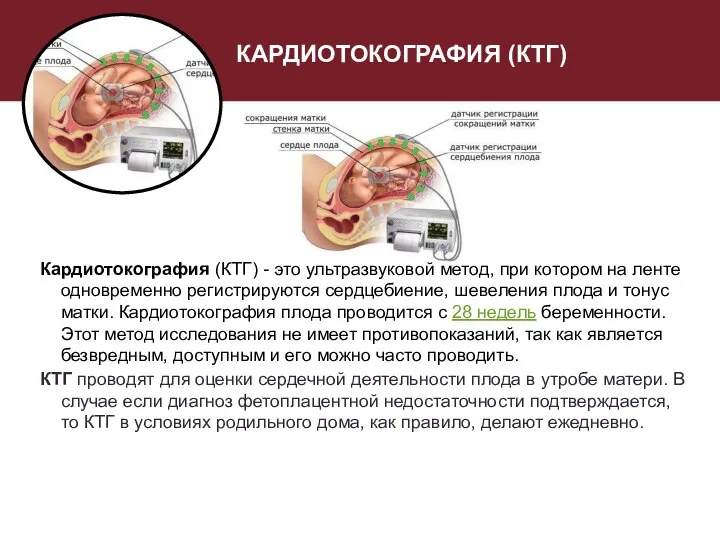 КАРДИОТОКОГРАФИЯ (КТГ) Кардиотокография (КТГ) - это ультразвуковой метод, при котором на