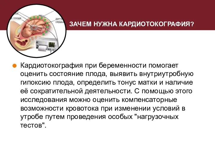 ЗАЧЕМ НУЖНА КАРДИОТОКОГРАФИЯ? Кардиотокография при беременности помогает оценить состояние плода, выявить