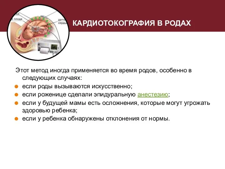 КАРДИОТОКОГРАФИЯ В РОДАХ Этот метод иногда применяется во время родов, особенно