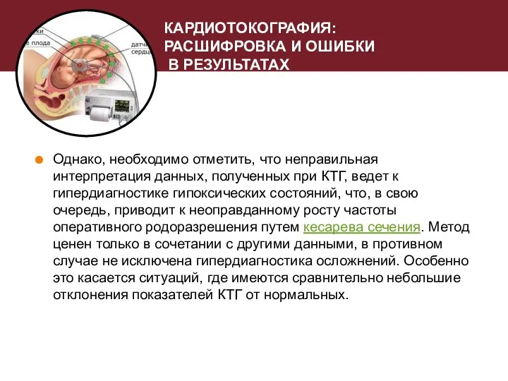 КАРДИОТОКОГРАФИЯ: РАСШИФРОВКА И ОШИБКИ В РЕЗУЛЬТАТАХ Однако, необходимо отметить, что неправильная