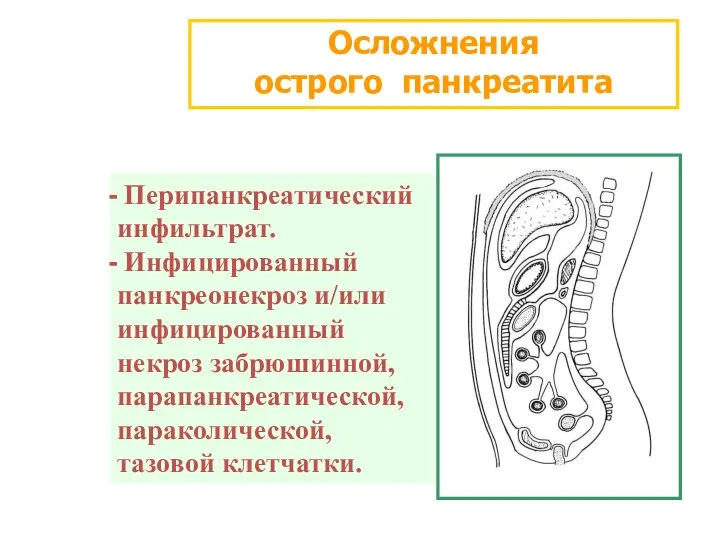 Осложнения острого панкреатита Перипанкреатический инфильтрат. Инфицированный панкреонекроз и/или инфицированный некроз забрюшинной, парапанкреатической, параколической, тазовой клетчатки.