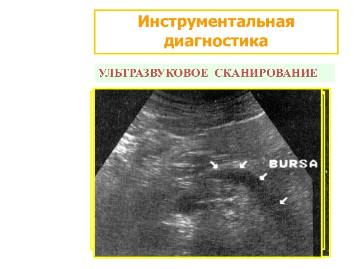 Инструментальная диагностика УЛЬТРАЗВУКОВОЕ СКАНИРОВАНИЕ