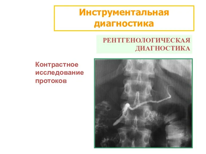 Инструментальная диагностика РЕНТГЕНОЛОГИЧЕСКАЯ ДИАГНОСТИКА Контрастное исследование протоков