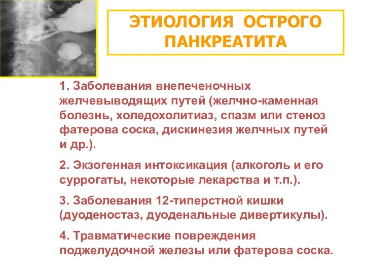 ЭТИОЛОГИЯ ОСТРОГО ПАНКРЕАТИТА 1. Заболевания внепеченочных желчевыводящих путей (желчно-каменная болезнь, холедохолитиаз,