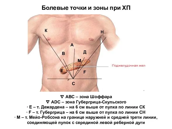 Болевые точки и зоны при ХП ∇ АВС – зона Шоффара