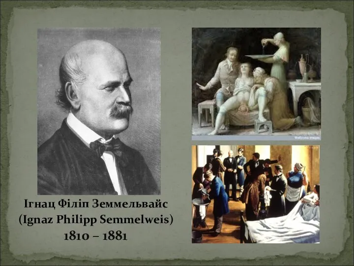 Ігнац Філіп Земмельвайс (Ignaz Philipp Semmelweis) 1810 – 1881