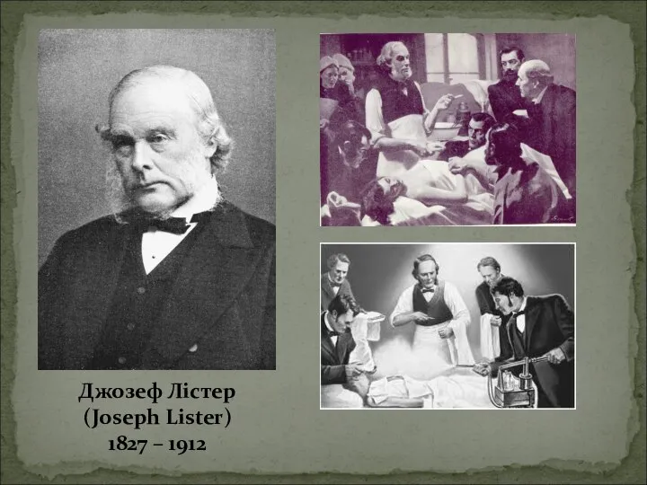 Джозеф Лістер (Joseph Lister) 1827 – 1912