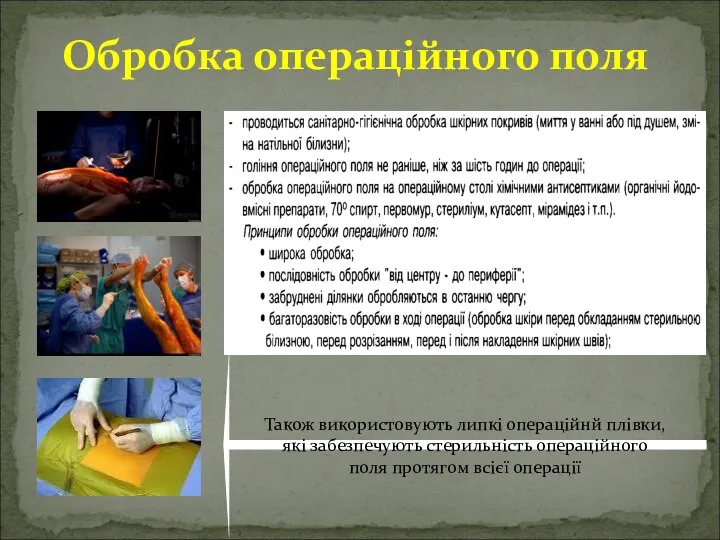 Обробка операційного поля Також використовують липкі операційнй плівки, які забезпечують стерильність операційного поля протягом всієї операції