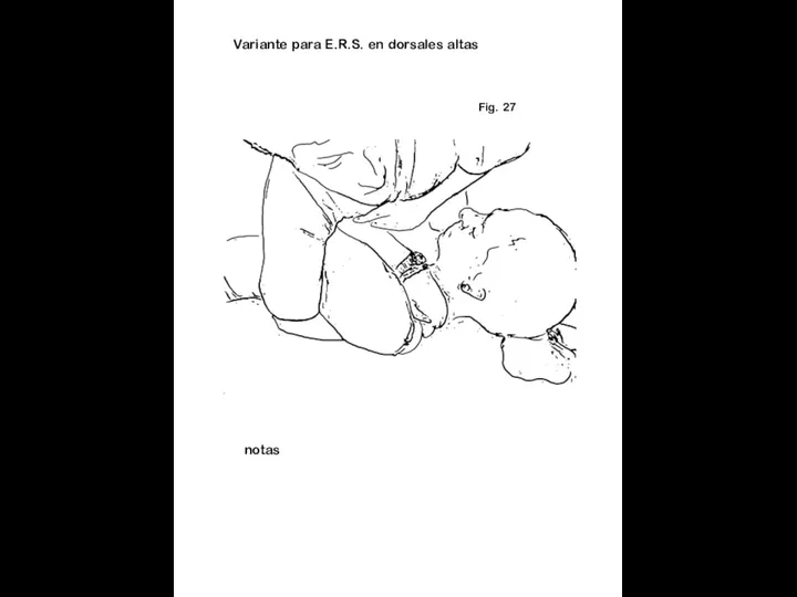 Fig. 27 notas Variante para E.R.S. en dorsales altas