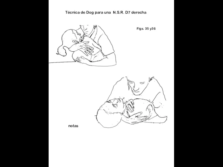 Figs. 35 y36 notas Técnica de Dog para una N.S.R. D7 derecha