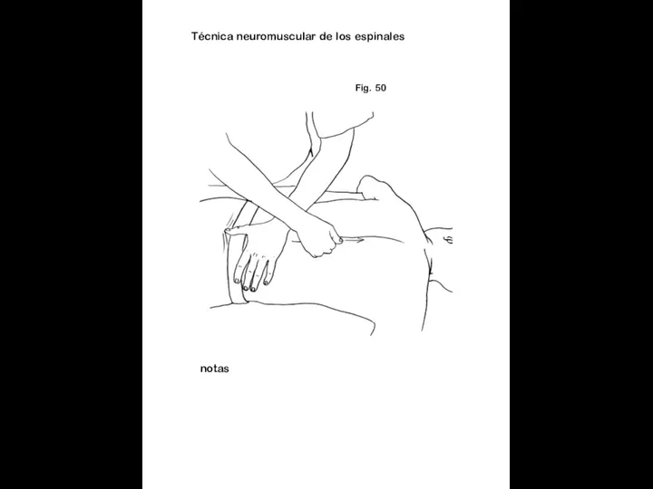 Fig. 50 notas Técnica neuromuscular de los espinales