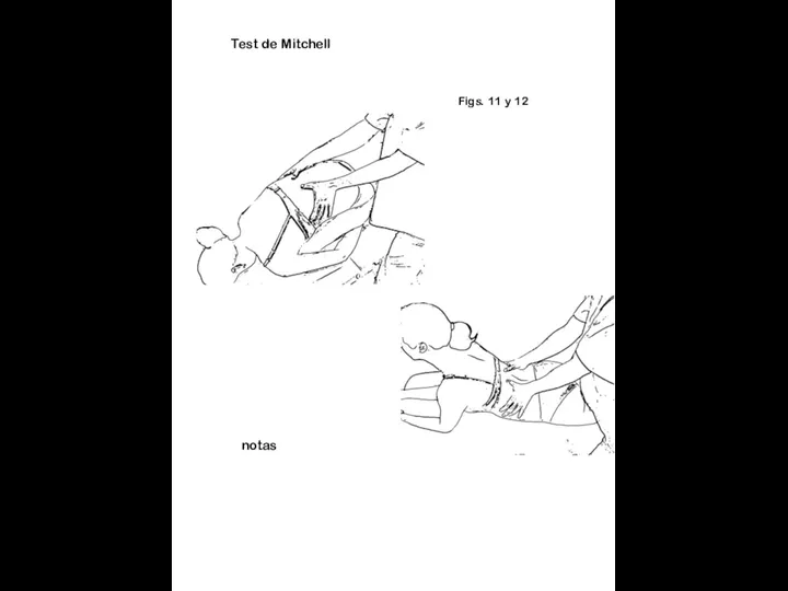 Figs. 11 y 12 notas Test de Mitchell