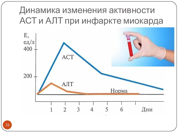 Динамика изменения активности АСТ и АЛТ при инфаркте миокарда