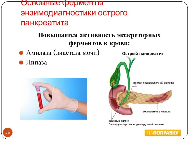 Основные ферменты энзимодиагностики острого панкреатита Повышается активность экскреторных ферментов в крови: Амилаза (диастаза мочи) Липаза