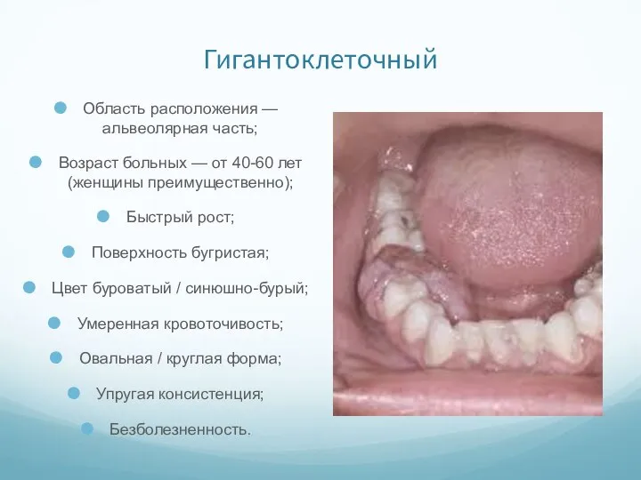 Гигантоклеточный Область расположения — альвеолярная часть; Возраст больных — от 40-60