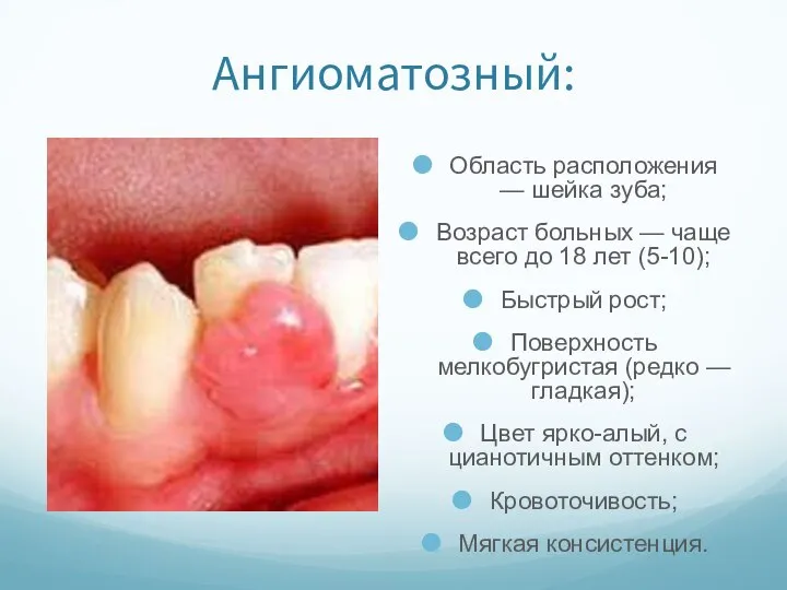 Ангиоматозный: Область расположения — шейка зуба; Возраст больных — чаще всего