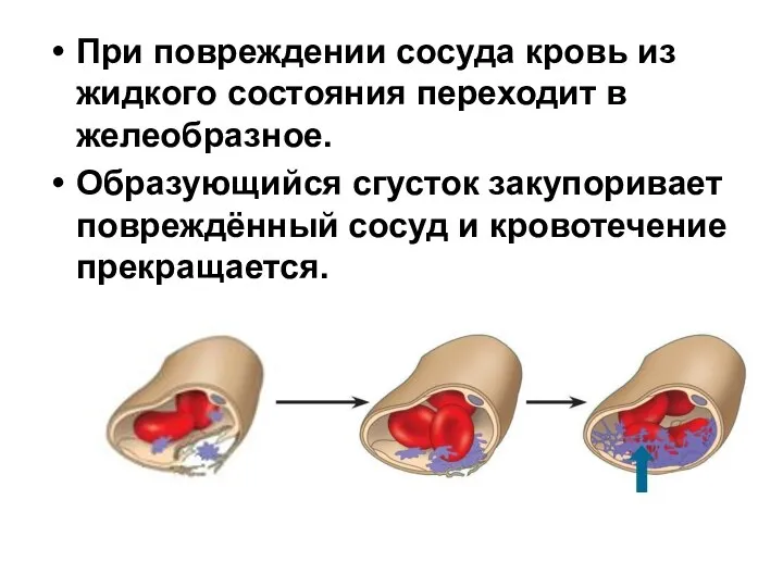 При повреждении сосуда кровь из жидкого состояния переходит в желеобразное. Образующийся