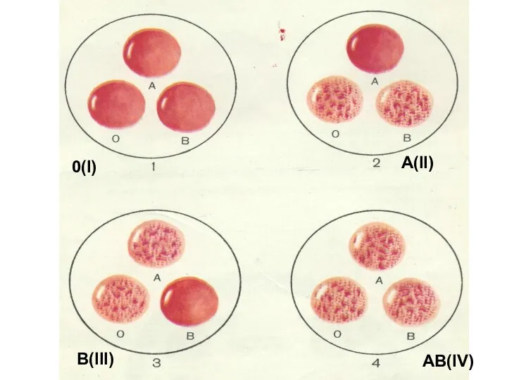 0(I) A(II) B(III) AB(IV)