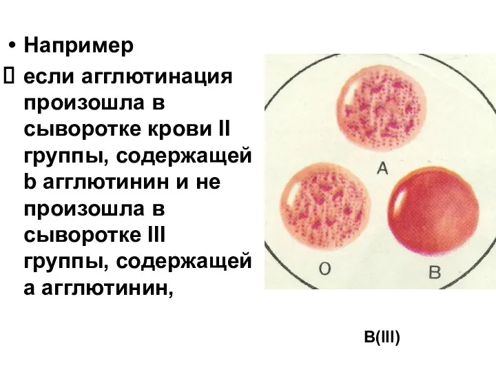 Например если агглютинация произошла в сыворотке крови II группы, содержащей b