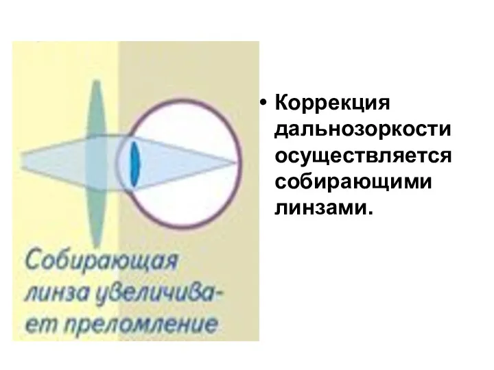 Коррекция дальнозоркости осуществляется собирающими линзами.