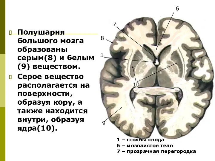 Полушария большого мозга образованы серым(8) и белым(9) веществом. Серое вещество располагается