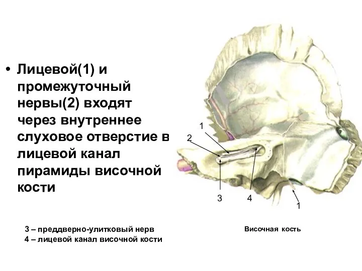 Лицевой(1) и промежуточный нервы(2) входят через внутреннее слуховое отверстие в лицевой