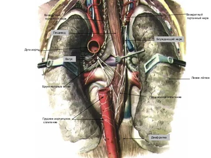Возвратный гортанный нерв Блуждающий нерв Пищеводное сплетение Возвратный гортанный нерв Вагус