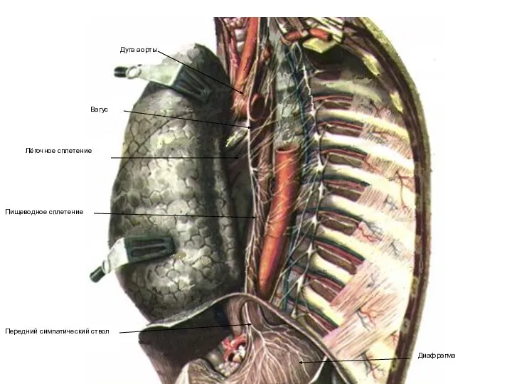 Вагус Пищеводное сплетение Лёгочное сплетение Передний симпатический ствол Диафрагма Дуга аорты