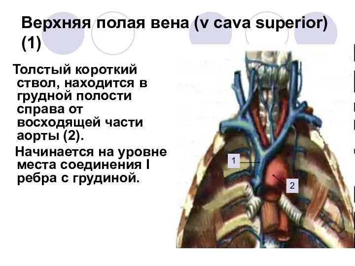 Верхняя полая вена (v cava superior) (1) Толстый короткий ствол, находится