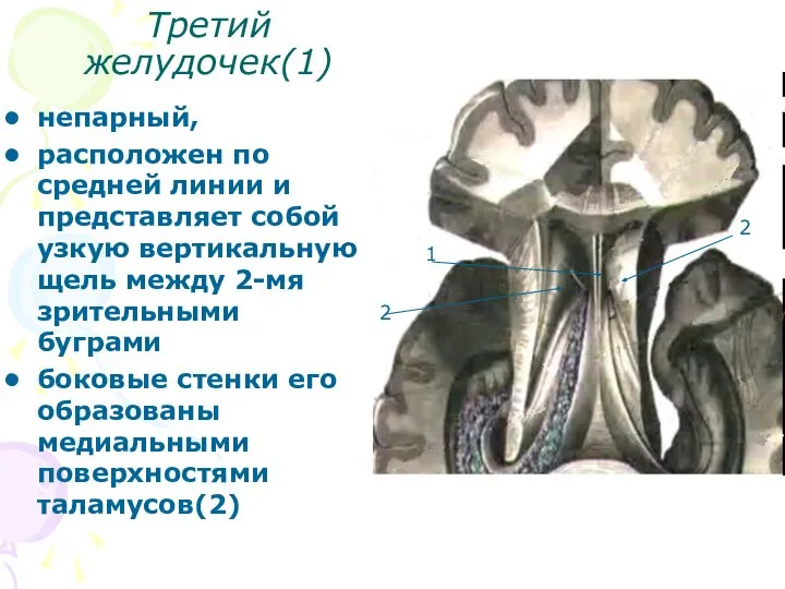 Третий желудочек(1) непарный, расположен по средней линии и представляет собой узкую