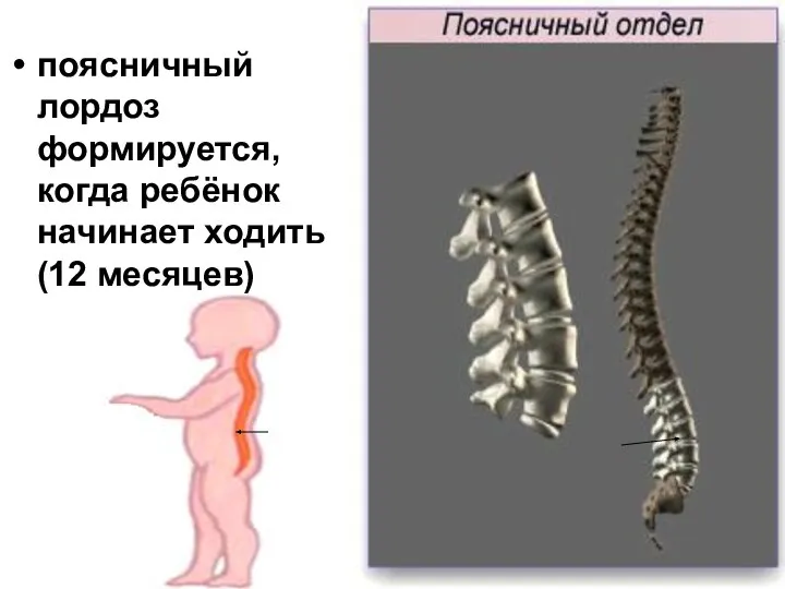 поясничный лордоз формируется, когда ребёнок начинает ходить (12 месяцев)