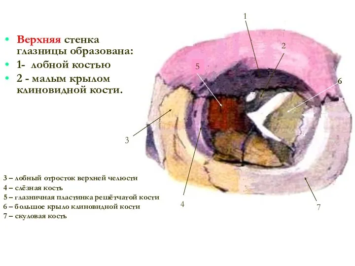 Верхняя стенка глазницы образована: 1- лобной костью 2 - малым крылом