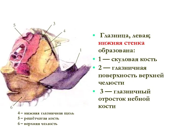 Глазница, левая; нижняя стенка образована: 1 — скуловая кость 2 —