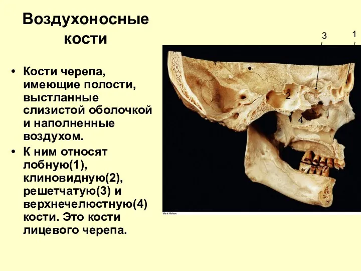 Воздухоносные кости Кости черепа, имеющие полости, выстланные слизистой оболочкой и наполненные