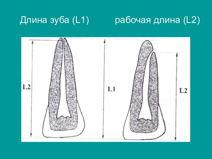 Длина зуба (L1) рабочая длина (L2)