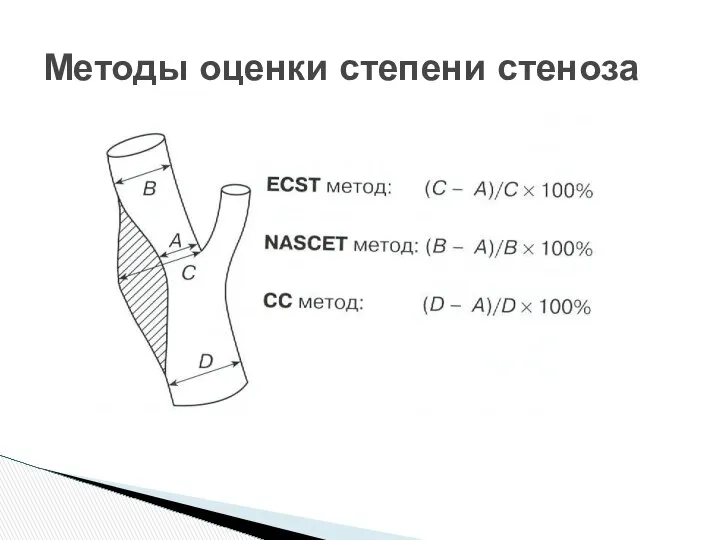 Методы оценки степени стеноза