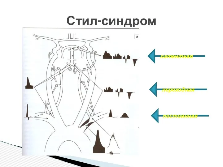 Стил-синдром латентная переходная постоянная