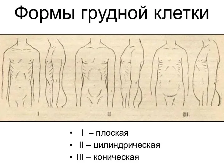 Формы грудной клетки I – плоская II – цилиндрическая III – коническая