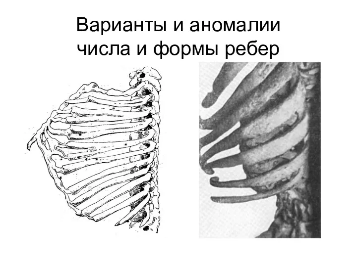 Варианты и аномалии числа и формы ребер