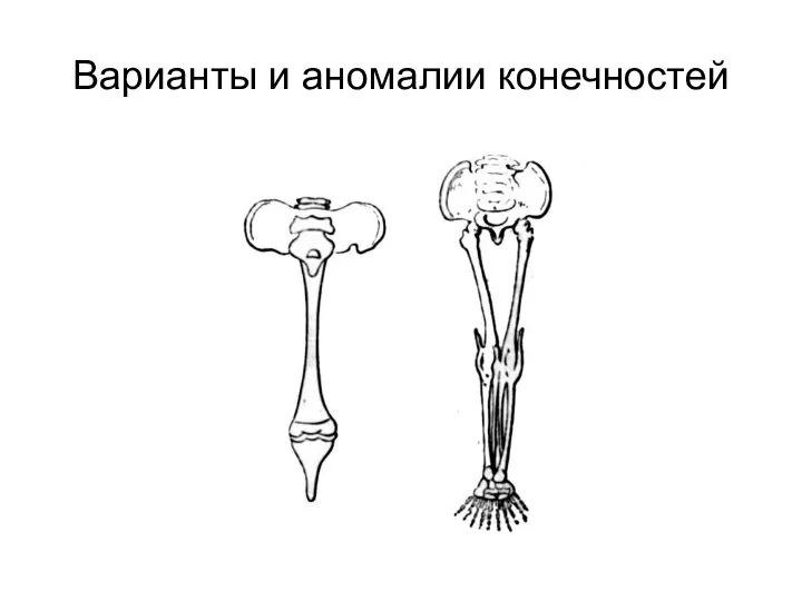 Варианты и аномалии конечностей