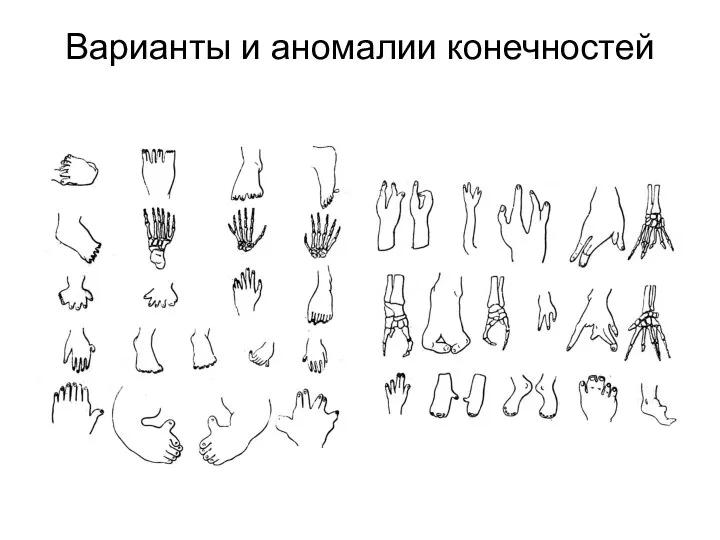 Варианты и аномалии конечностей