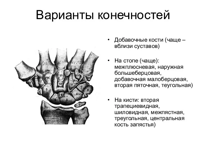 Варианты конечностей Добавочные кости (чаще – вблизи суставов) На стопе (чаще):