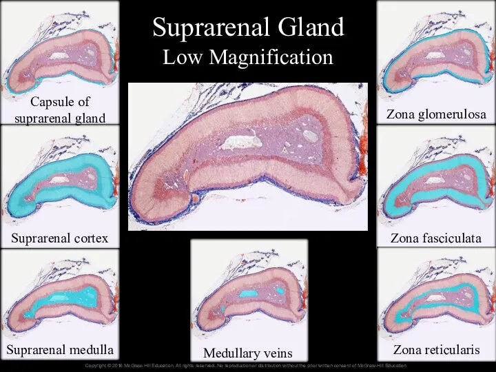 Suprarenal Gland Low Magnification Capsule of suprarenal gland Suprarenal cortex Suprarenal