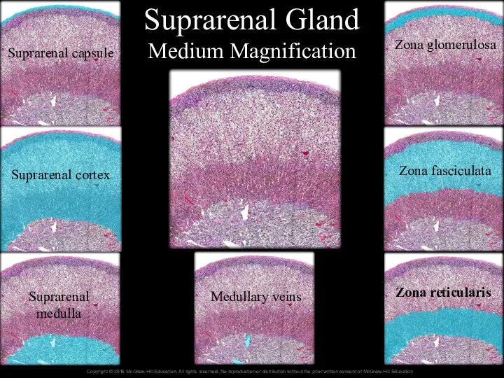 Suprarenal Gland Medium Magnification Suprarenal capsule Suprarenal cortex Suprarenal medulla Medullary