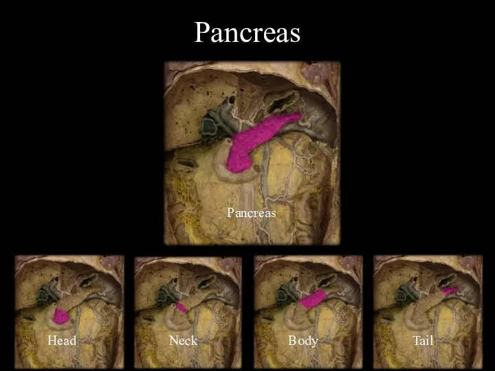 Pancreas Head Neck Body Tail Pancreas