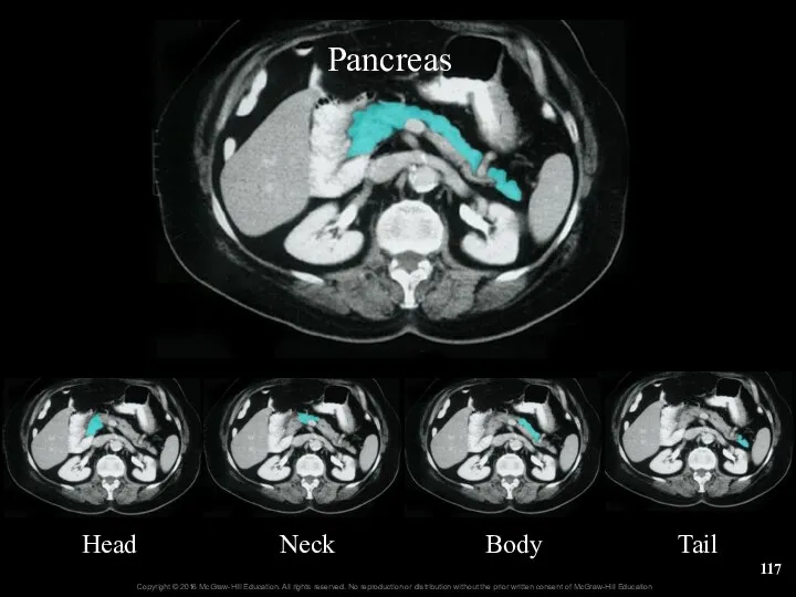 Pancreas Head Neck Body Tail