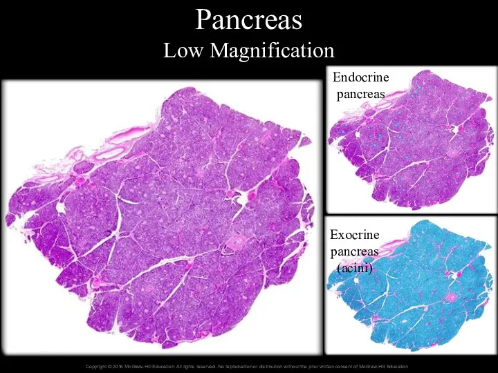 Pancreas Low Magnification Endocrine pancreas Exocrine pancreas (acini)