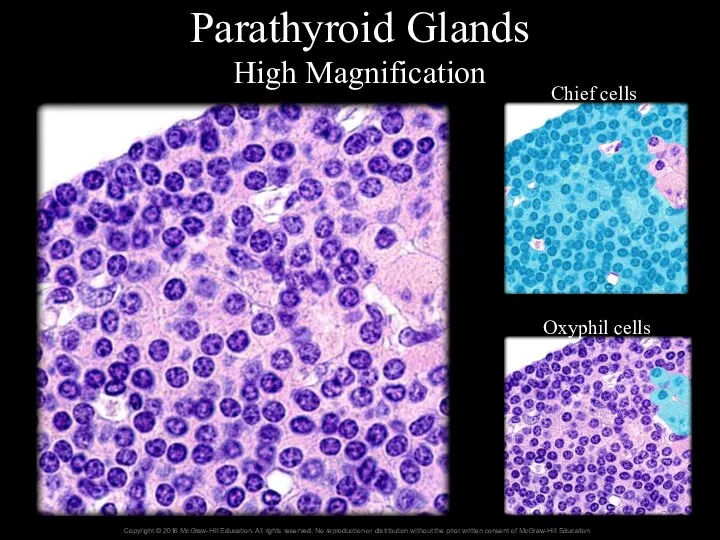 Parathyroid Glands High Magnification Chief cells Oxyphil cells