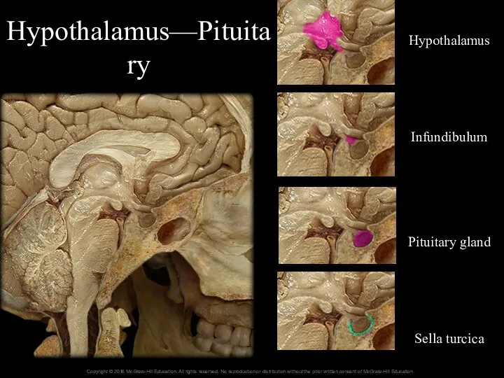 Hypothalamus—Pituitary Hypothalamus Infundibulum Pituitary gland Sella turcica